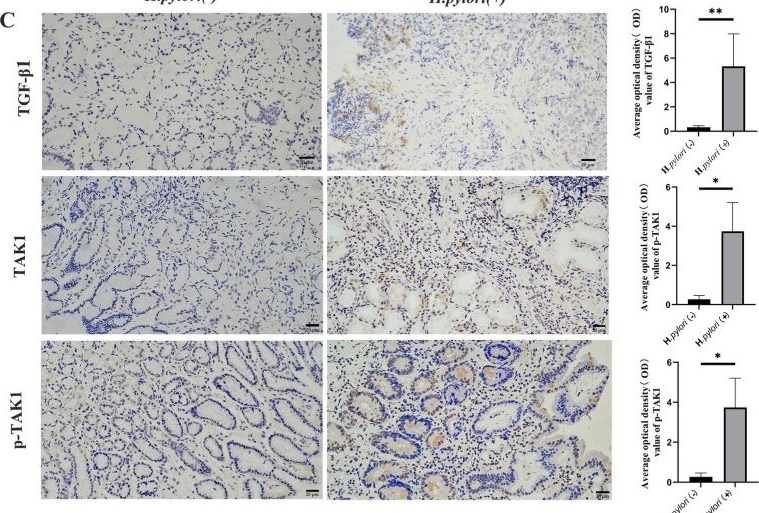 Fig.4.C showing Immunohistochemistry from the publication: Gastric mucosal proteomic analysis reveals the role of the TGF-β signaling pathway in gastritis associated with Helicobacter pylori infection.