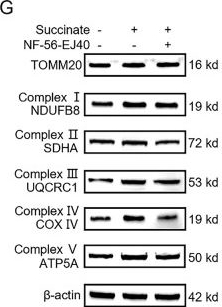 Fig.5.G showing Western Blotting from the publication: SDHA Deficiency in Hepatocellular Carcinoma Promotes Tumor Progression through Succinate-Induced M2 Macrophage Polarization.