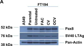 Fig.5.A showing Western Blotting from the publication: Chronic iron exposure and c-Myc/H-ras-mediated transformation in fallopian tube cells alter the expression of EVI1, amplified at 3q26.2 in ovarian cancer.