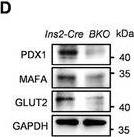 Fig.2.D showing Western Blotting in a Mus musculus (House mouse) sample from the publication: Beta-Cell Tipe1 Orchestrates Insulin Secretion and Cell Proliferation by Promoting Gαs/cAMP Signaling via USP5.