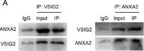 Fig.4.A showing Western Blotting in a Homo sapiens (Human) sample from the publication: VSIG2 hinders gastric cancer progression by suppressing ANXA2-mediated NF-κB pathway activation.