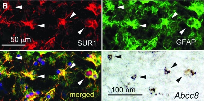 Fig.4.B showing Immunohistochemistry-immunofluorescence in a Homo sapiens (Human) sample from the publication: Sulfonylurea Receptor 1, Transient Receptor Potential Cation Channel Subfamily M Member 4, and KIR6.2:Role in Hemorrhagic Progression of Contusion.