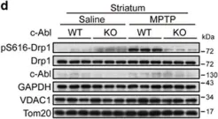 Fig.1.D showing Western Blotting from the publication: c-Abl-mediated Drp1 phosphorylation promotes oxidative stress-induced mitochondrial fragmentation and neuronal cell death.