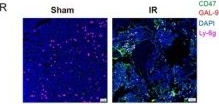 Fig.6.R showing Immunohistochemistry-immunofluorescence in a Mus musculus (House mouse) sample from the publication: Galectin-9high Neutrophils Exacerbate Radiation-Induced Frailty.