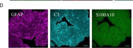 Fig.1.D showing Immunohistochemistry-immunofluorescence in a Homo sapiens (Human) sample from the publication: Nicotinamide riboside reduces glial inflammation and boosts mitochondrial function.