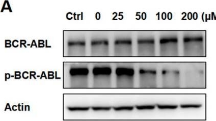 Fig.5.A showing Western Blotting in a Homo sapiens (Human) sample from the publication: Unlocking the Potential of Perillaldehyde: A Novel Mechanism for Chronic Myeloid Leukemia by Targeting HSP70.