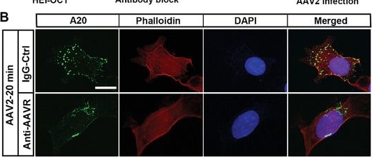 mengtianfang5様【A02x2 A07x2 A19 A20 他】 anti-AAV2 (intact particle) mouse monoclonal, A20, lyophilized