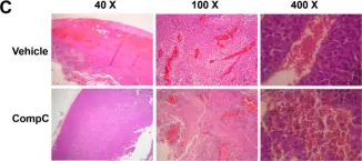 Fig.5.C showing Immunohistochemistry-paraffin in a Mus musculus (House mouse) sample from the publication: Compound C Inhibits B16-F1 Tumor Growth in a Syngeneic Mouse Model Via the Blockage of Cell Cycle Progression and Angiogenesis.
