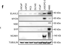 Fig.1.F showing Western Blotting from the publication: The ELAVL3/MYCN positive feedback loop provides a therapeutic target for neuroendocrine prostate cancer.