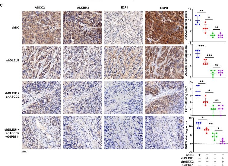Fig.7.C showing Immunohistochemistry in a Homo sapiens (Human) sample from the publication: Histone modification-regulated LncRNA DLEU1 interacts with ASCC2/ALKBH3 complex to drive DNA repair, antioxidant homeostasis and glucose metabolism in gastric cancer.