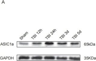 Fig.2.A showing Western Blotting in a Mus musculus (House mouse) sample from the publication: Inhibition of ASIC1a Attenuates Neuronal Pyroptosis and Neuroinflammation Following Traumatic Brain Injury.