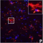 Fig.7.P showing Immunocytochemistry-immunofluorescence in a Mus musculus (House mouse) sample from the publication: IFN-gamma signaling in the central nervous system controls the course of experimental autoimmune encephalomyelitis independently of the localization and composition of inflammatory foci.