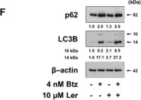 Fig.3.F showing Western Blotting in a Homo sapiens (Human) sample from the publication: Lercanidipine Synergistically Enhances Bortezomib Cytotoxicity in Cancer Cells via Enhanced Endoplasmic Reticulum Stress and Mitochondrial Ca2+ Overload.