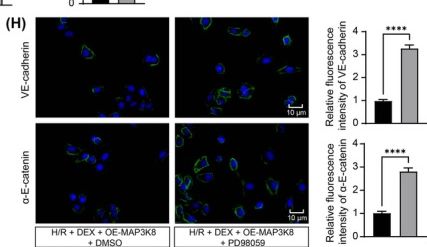 Fig.5.H showing Immunocytochemistry-immunofluorescence from the publication: Dexmedetomidine Blocks the ERK Pathway by Inhibiting MAP3K8 to Achieve a Protective Effect in Lung Ischemia/Reperfusion Injury.