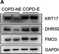 Fig.6.A showing Western Blotting from the publication: Identification of Proteomic Signatures in Chronic Obstructive Pulmonary Disease Emphysematous Phenotype.