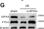 Fig.3.G showing Western Blotting from the publication: Surface-cleaned black phosphorus nanosheets chelate iron and rebalance the ferroptosis-immune axis in acute kidney injury.