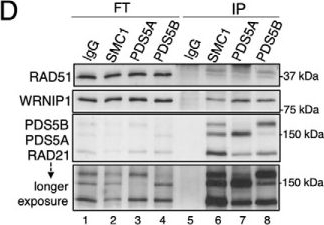 Fig.5.D showing Western Blotting from the publication: PDS5 proteins are required for proper cohesin dynamics and participate in replication fork protection.
