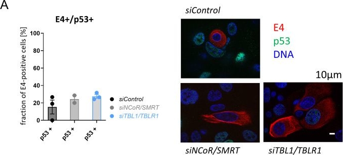 Fig.7.A showing Immunocytochemistry-immunofluorescence from the publication: Inhibition of high risk HPV31 E8^E2 repressor activity enables differentiation-independent genome amplification and E4 expression.