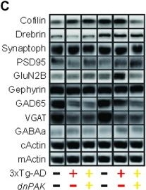 Transgenic autoinhibition of p21-activated kinase exacerbates synaptic impairments and fronto-dependent behavioral deficits in an animal model of Alzheimer's disease.