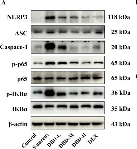 Fig.9.A showing Western Blotting from the publication: Danggui Buxue Decoction Attenuates Staphylococcus aureus-Induced Mastitis in Mice Associated with Gut Microbiota Remodeling, Blood-Milk Barrier Protection, and Inflammatory Suppression.