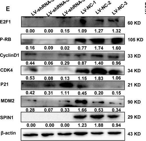 Fig.6.E showing Western Blotting from the publication: E2F1-activated SPIN1 promotes tumor growth via a MDM2-p21-E2F1 feedback loop in gastric cancer.