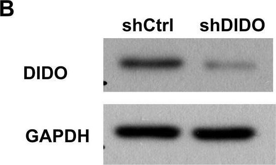 Fig.2.B showing Western Blotting from the publication: In leukemia, knock-down of the death inducer-obliterator gene would inhibit the proliferation of endothelial cells by inhibiting the expression of CDK6 and CCND1.