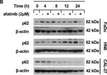 Fig.2.B showing Western Blotting from the publication: Afatinib induces pro-survival autophagy and increases sensitivity to apoptosis in stem-like HNSCC cells.