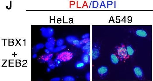 Fig.3.J showing Immunocytochemistry-immunofluorescence in a Homo sapiens (Human) sample from the publication: TBX1 targets the miR-200-ZEB2 axis to induce epithelial differentiation and inhibit stem cell properties.