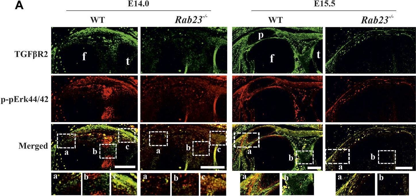 Fig.5.A showing Immunohistochemistry-immunofluorescence in a Mus musculus (House mouse) sample from the publication: RAB23 regulates musculoskeletal development and patterning.
