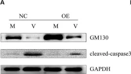 Fig.6.A showing Western Blotting from the publication: Herpes Simplex Virus 1-Induced Blood-Brain Barrier Damage Involves Apoptosis Associated With GM130-Mediated Golgi Stress.