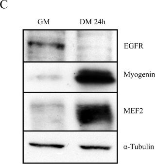 Fig.1.C showing Western Blotting from the publication: Epidermal growth factor receptor down-regulation triggers human myoblast differentiation.