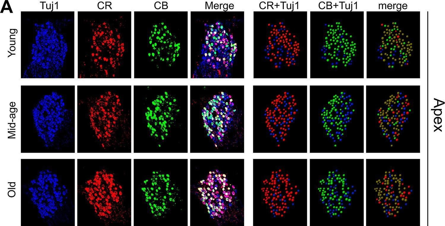 Fig.3.A showing Immunocytochemistry-immunofluorescence in a Mus musculus (House mouse) sample from the publication: Apical-basal distribution of different subtypes of spiral ganglion neurons in the cochlea and the changes during aging.