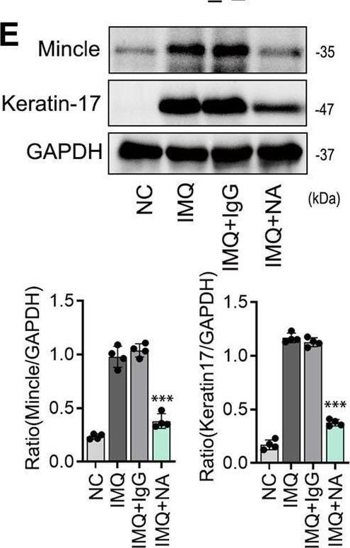 Fig.7.E showing Western Blotting in a Mus musculus (House mouse) sample from the publication: Macrophages mediate psoriasis via Mincle-dependent mechanism in mice.
