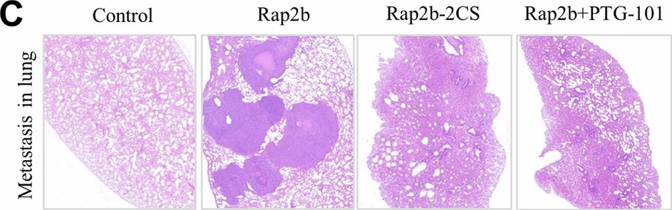 Fig.8.C showing Immunohistochemistry in a Mus musculus (House mouse) sample from the publication: Inhibiting S-palmitoylation arrests metastasis by relocating Rap2b from plasma membrane in colorectal cancer.