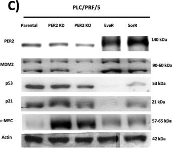Fig.7.C showing Western Blotting in a Homo sapiens (Human) sample from the publication: PER2 expression and cellular localization play a critical role in tumor aggressiveness and drug resistance in an in vitro model of hepatocellular carcinoma.