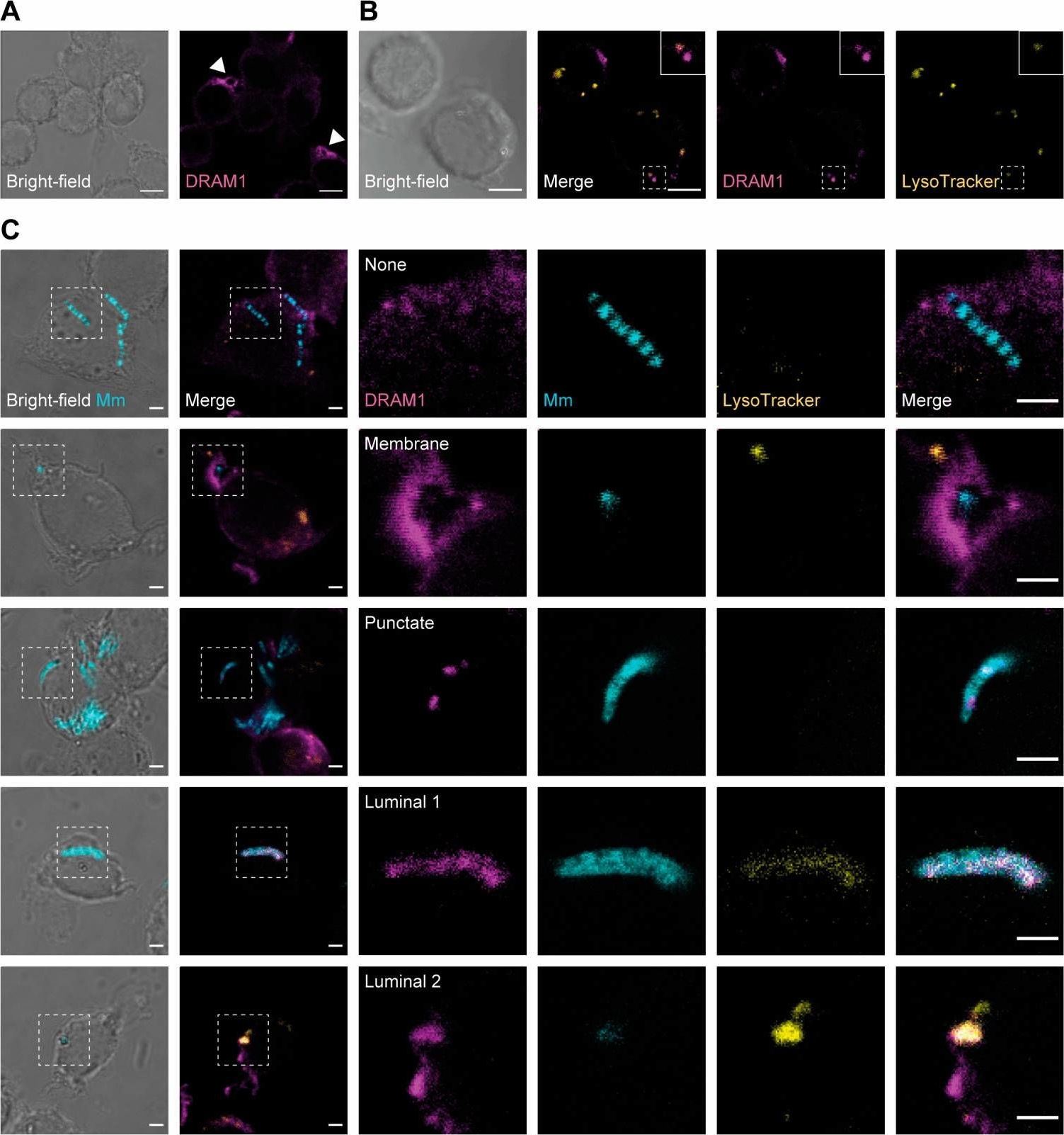 Fig.1.A,B,C showing Immunocytochemistry-immunofluorescence in a Mus musculus (House mouse) sample from the publication: DRAM1 Promotes Lysosomal Delivery of Mycobacterium marinum in Macrophages.
