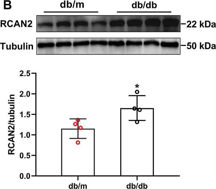 Fig.1.B showing Western Blotting in a Mus musculus (House mouse) sample from the publication: Elevated Serum Regulator of Calcineurin 2 is Associated With an Increased Risk of Non-Alcoholic Fatty Liver Disease.