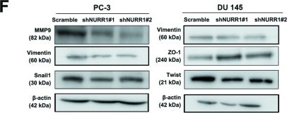 Fig.6.F showing Western Blotting from the publication: Nuclear receptor NURR1 functions to promote stemness and epithelial-mesenchymal transition in prostate cancer via its targeting of Wnt/β-catenin signaling pathway.