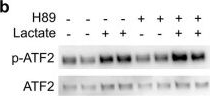 Fig.8.B showing Western Blotting from the publication: Activation of GPR81 by lactate drives tumour-induced cachexia.