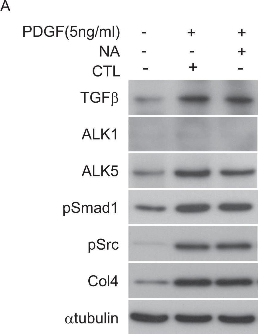 Activation of Src mediates PDGF-induced Smad1 phosphorylation and contributes to the progression of glomerulosclerosis in glomerulonephritis.