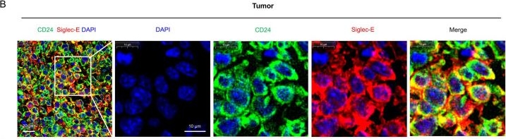 Fig.7.B showing Immunohistochemistry-immunofluorescence from the publication: ST8SIA6 Sialylates CD24 to Enhance Its Membrane Localization in BRCA.
