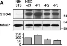 Fig.3.A showing Western Blotting from the publication: Fusion protein of retinol-binding protein and albumin domain III reduces liver fibrosis.