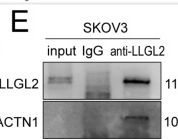 Fig.5.E showing Western Blotting from the publication: LLGL2 Inhibits Ovarian Cancer Metastasis by Regulating Cytoskeleton Remodeling via ACTN1.