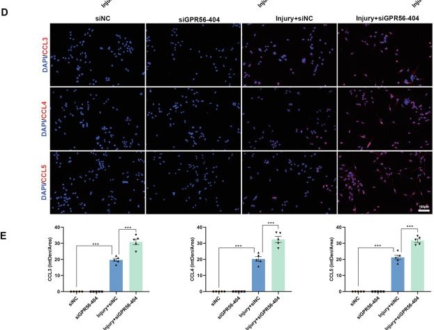 Fig.7.D showing Immunocytochemistry-immunofluorescence in a Mus musculus (House mouse) sample from the publication: Genetic deletion of G protein-coupled receptor 56 aggravates traumatic brain injury through the microglial CCL3/4/5 upregulation targeted to CCR5.