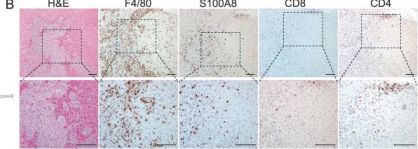 CD8α Antibody (D4W2Z) XP® Rabbit mAb | Cell Signaling Technology