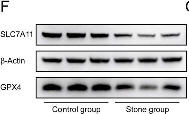 Fig.3.F showing Western Blotting in a Mus musculus (House mouse) sample from the publication: Dysregulated iron metabolism and kidney stone risk: an epidemiological and experimental study.