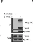 Fig.2.F showing Western Blotting in a Homo sapiens (Human) sample from the publication: SCFβ-TrCP-mediated degradation of TOP2β promotes cancer cell survival in response to chemotherapeutic drugs targeting topoisomerase II.