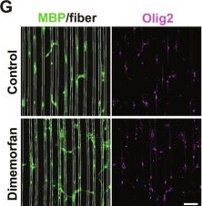 Fig.2.G showing Immunohistochemistry-immunofluorescence from the publication: Biomimetic Microfibers for Myelin-Enhancer Screening and Neural Regeneration.