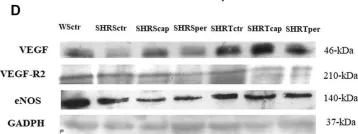 Fig.4.D showing Western Blotting from the publication: Exercise-induced angiogenesis is attenuated by captopril but maintained under perindopril treatment in hypertensive rats.
