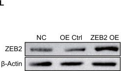 Fig.9.L showing Western Blotting in a Danio rerio (Zebrafish) sample from the publication: A diagnostic signatures for intervertebral disc degeneration using TNFAIP6 and COL6A2 based on single-cell RNA-seq and bulk RNA-seq analyses.